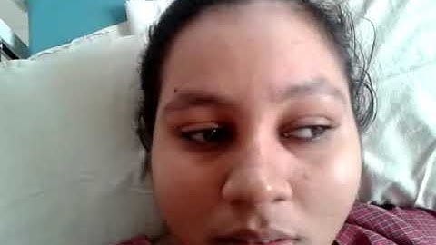 INO internuclear ophthalmoplegia video