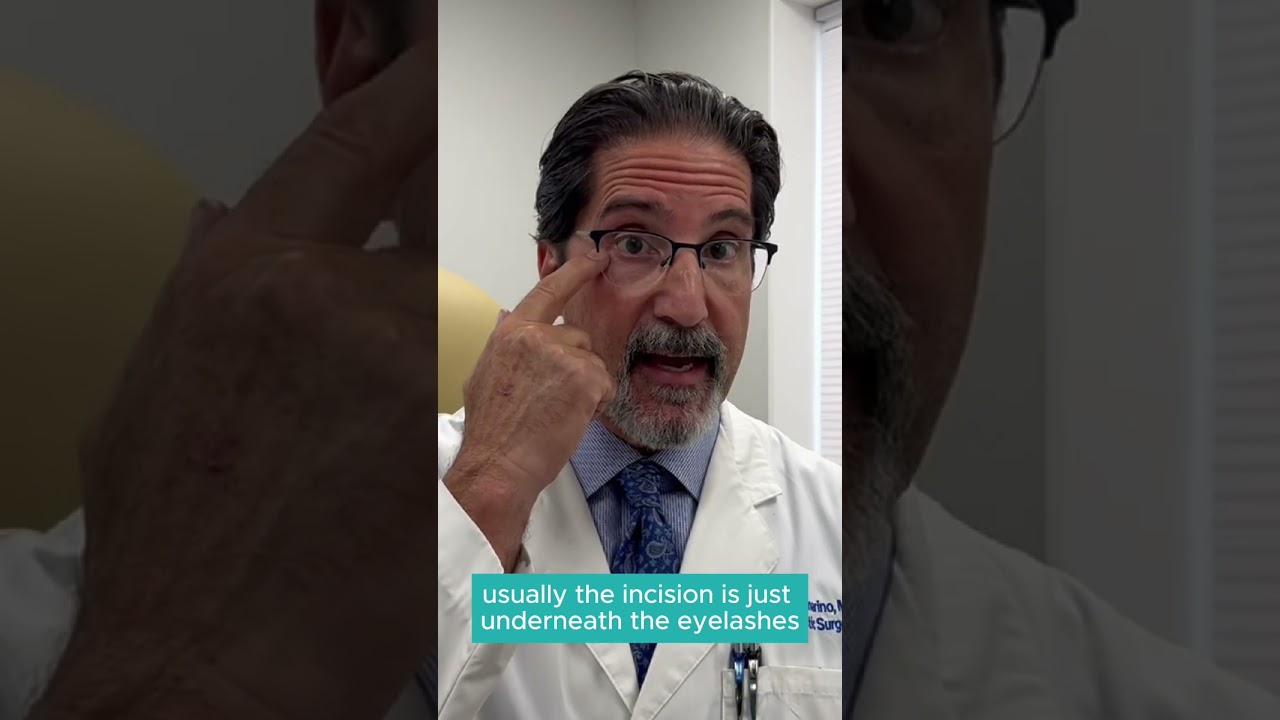 Where are eyelid surgery incisions made?
