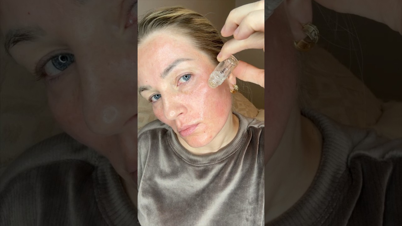 QURE SKINCARE MY 5 MONTH MICRO INFUSION SYSTEM REVIEW #qureskincare #microneedling #qure