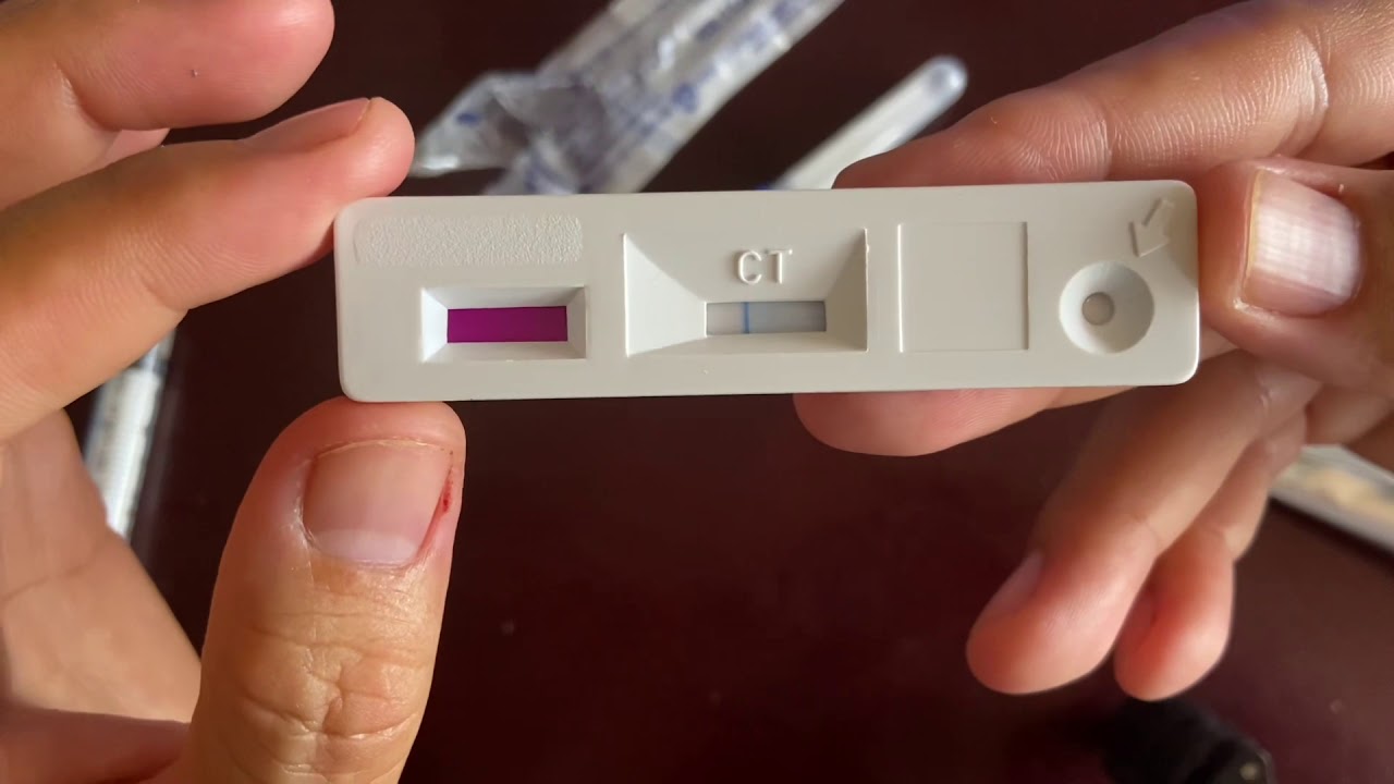 Cách test nhanh tả lợn Châu Phi (African Swine Fever Ag Rapid Test Kit ...