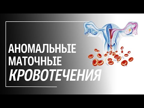 Аномальное маточное кровотечение при климаксе: причины, диагностика, лечение.