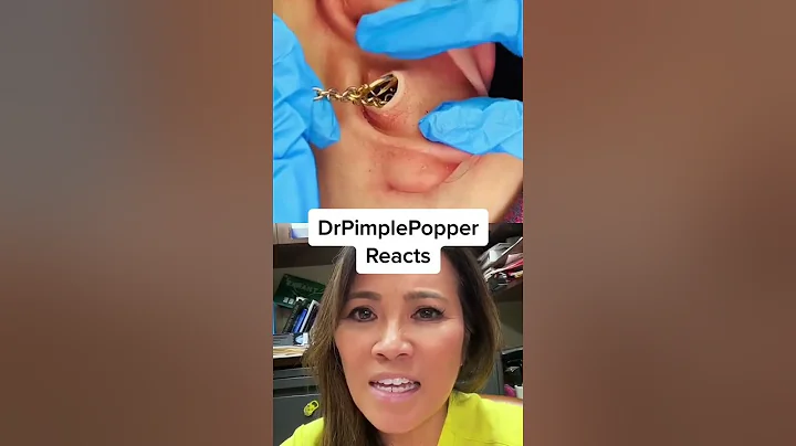 TOO SATISFYING TO BE REAL? Dr Pimple Popper Reacts - DayDayNews