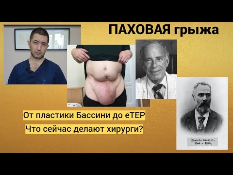 Паховая грыжа. От пластики Бассини до eTEP. Что сейчас делают хирурги.