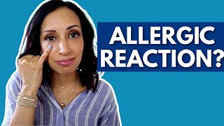 Allergic Reaction to Eye Makeup | Eye Doctor Explains