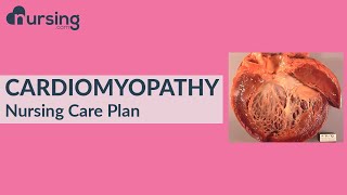Nursing Care Plan For Cardiomyopathy Nursing Care Plan Tutorial
