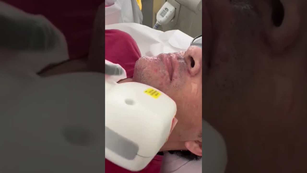 Depilação com Laser na Vila Leopoldina SP - Studio Taty Vicente