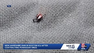 New Hampshire man hospitalized with rare Powassan virus after tick bite