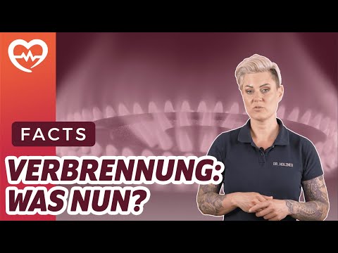 Video: Verbrennungen aufgrund von Wachseinwirkung behandeln – wikiHow