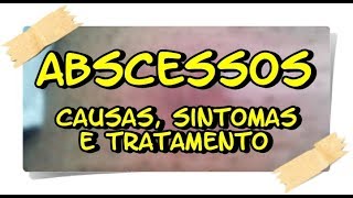 Pernas dor nas de abscesso dente causa
