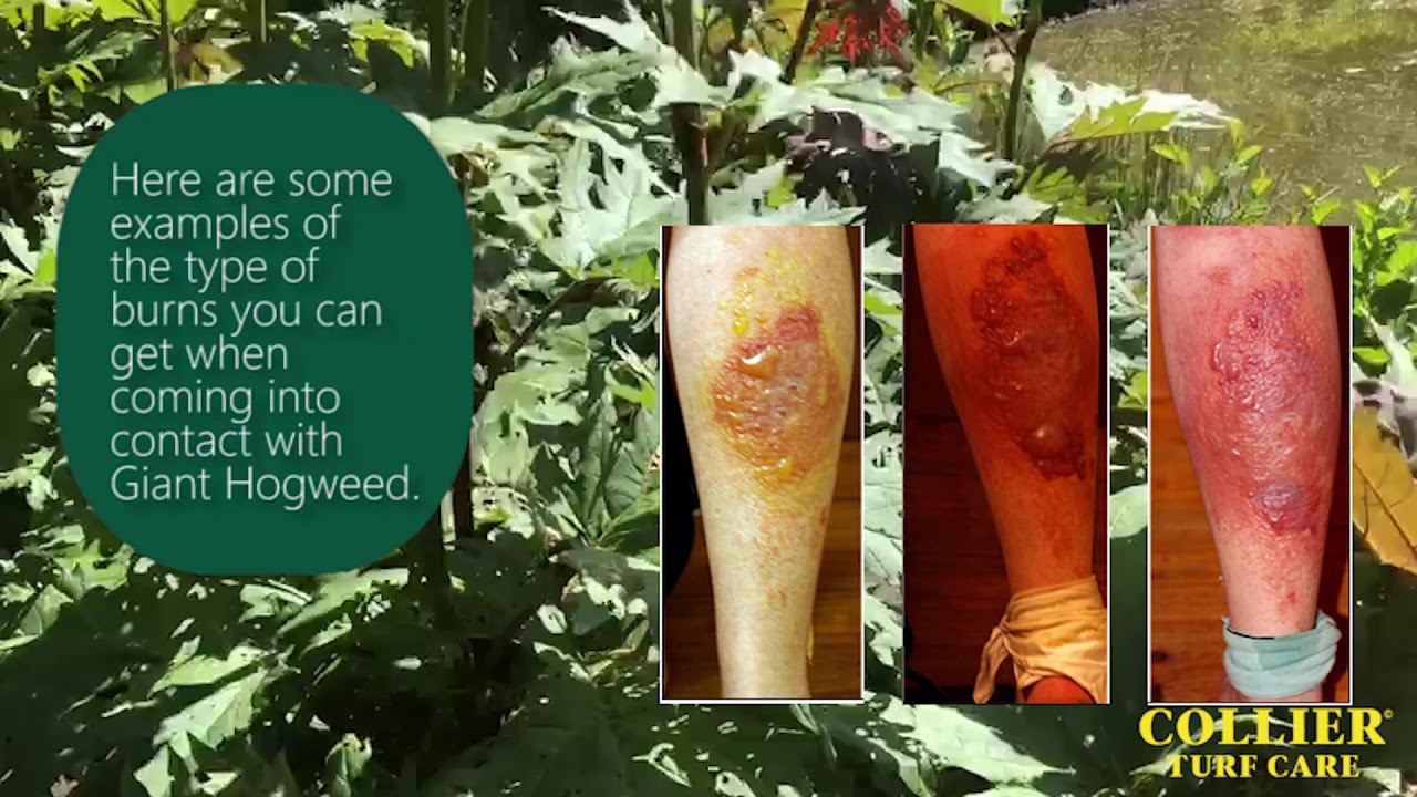 Giant Hogweed - The Dangers And How to Control It