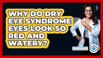 Why Do Dry Eye Syndrome Eyes Look So Red And Watery? - Optometry Knowledge Base