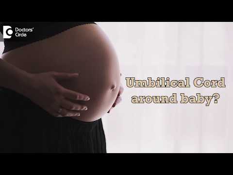 Video: Ano ang sanhi ng umbilical cord sa paligid ng leeg?