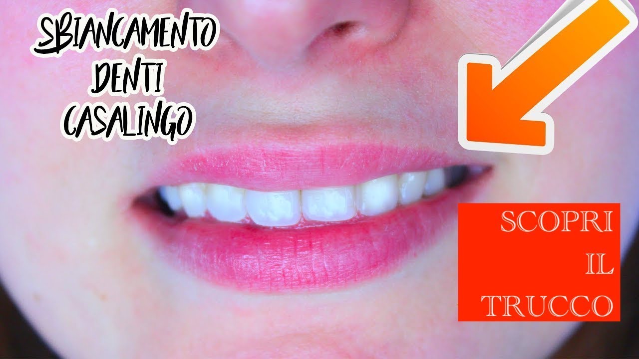 Denti Super Bianchi In 2 Minuti Veloce E Casalingo Youtube