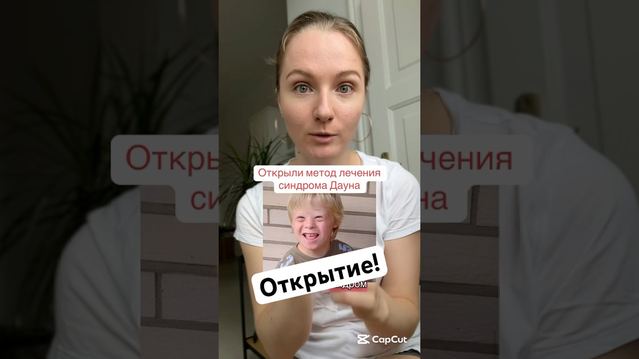 Нашли метод лечения синдрома Дауна 