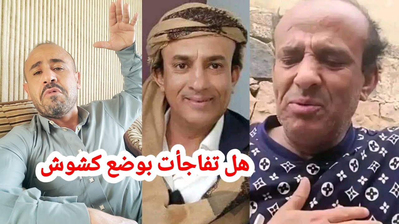 كشكوش | كم كان يستلم من التمثيل وكيف تسوي قناة تحقق ارباح وكم تربح من ألف مشاهدة