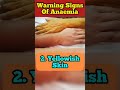 Warning signs of anaemia  health tips  113  shorts