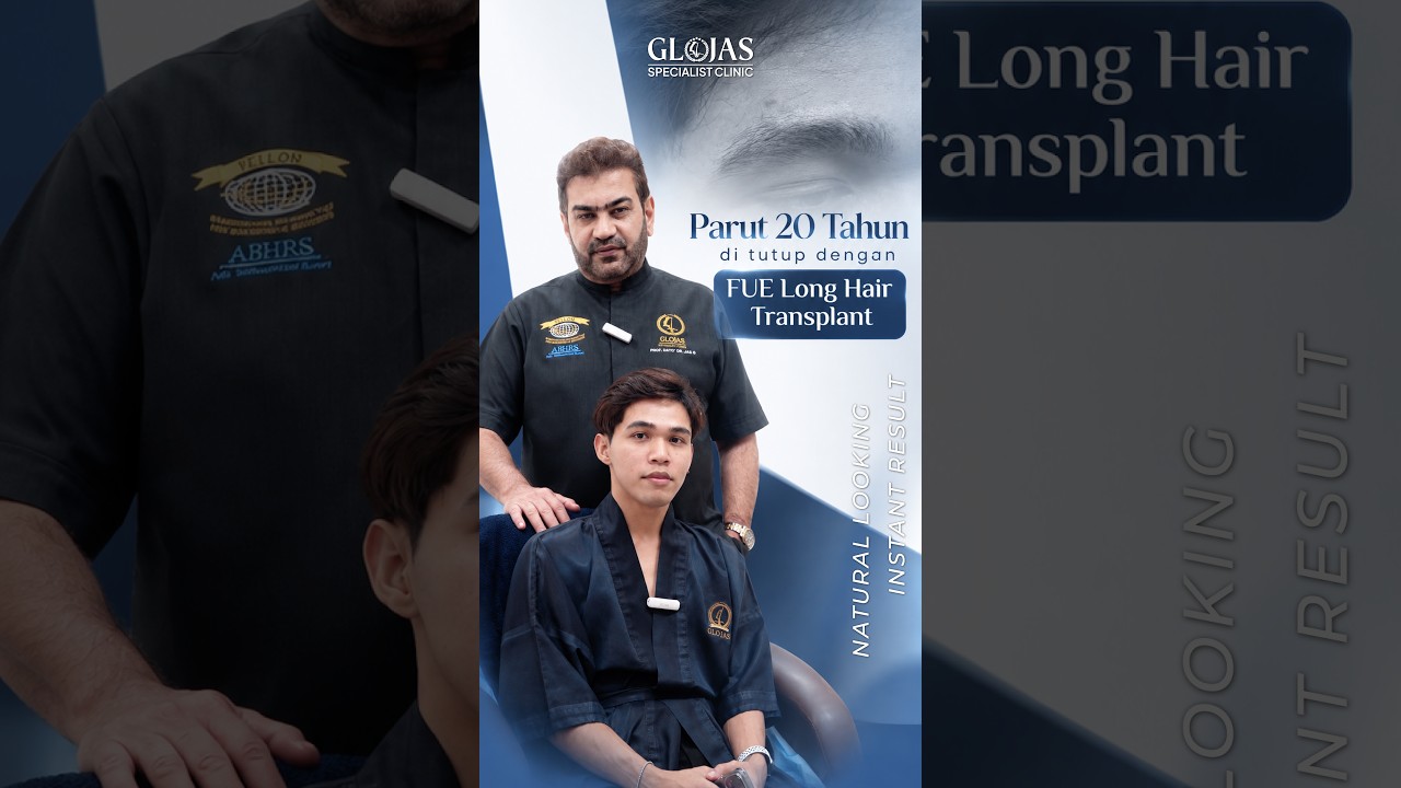 Our Doctors 16 Hair Transplant Malaysia l Parut 20 tahun kini hilang dengan FUE! ✨ #hairtransplantmalaysia