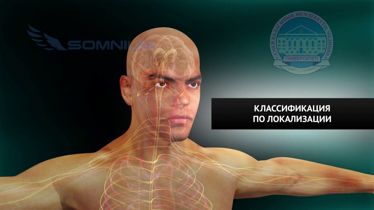 P05   Цереброваскулярные болезни