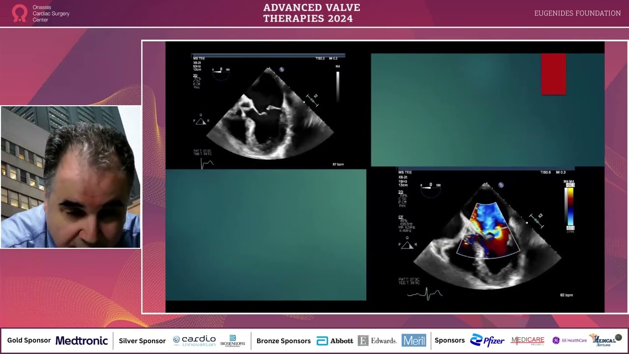 S. Lerakis | Anatomy and imaging in TMVR
