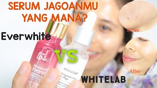 everwhite serum niacinamide