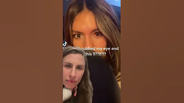 Bleeding Into Your Eyeball What Is Going On Here 