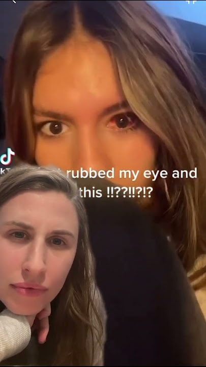 Bleeding Into Your Eyeball?! What is going on here???