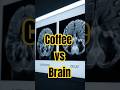 Coffee and Brain Aging: Harvard's 43-Year Study
