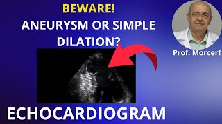 Three Necessary Findings to Call a LV Aneurysm.