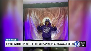 Toledo woman hosts wig giveaway for lupus patients during awareness month
