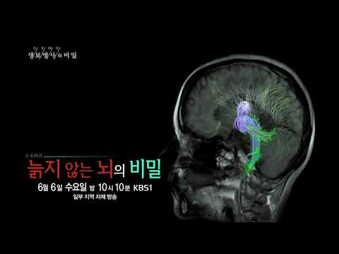 180606 생로병사의비밀 예고 ㅣ KBS방송