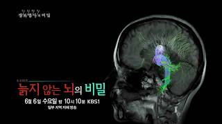 180606 생로병사의비밀 예고 ㅣ KBS방송