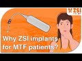 Why zsi implants for mtf patients