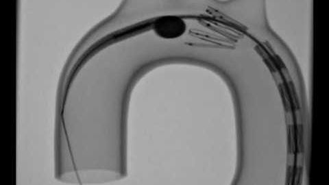 Zenith TX2 TAA Endovascular Graft - Glass Model Deployment