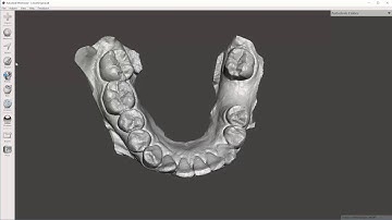 Video 2 of 5: MeshMixer Dental Model Trimming