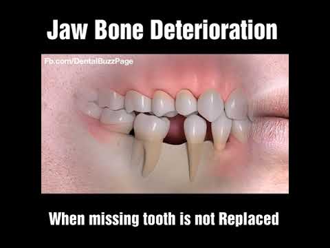 Video: Ar nyksta kaktos dantys?