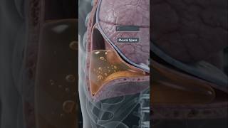 Pleural Effusion Explained | Causes, Symptoms, Diagnosis & Treatment | Fluid Around the Lungs