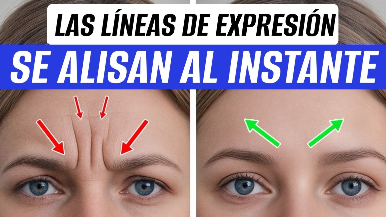 Mis pacientes están IMPACTADOS: la línea del entrecejo desaparece sin Botox con DOS ejercicios