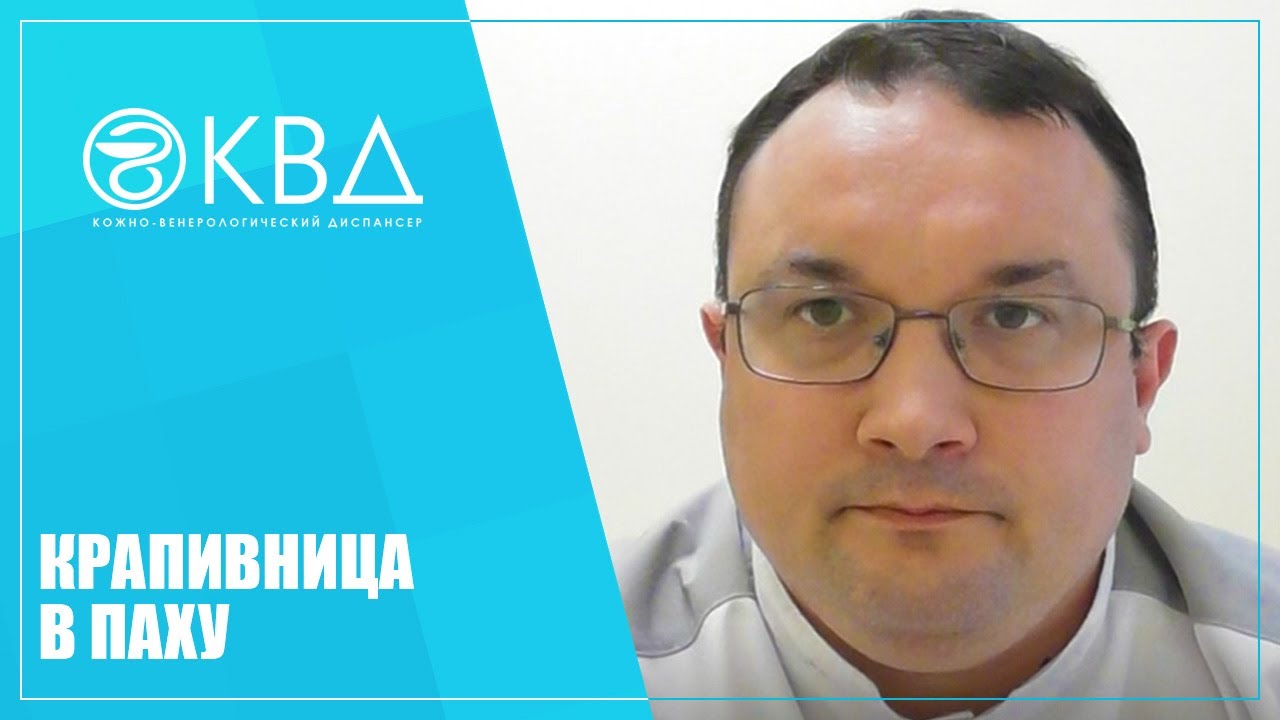 1169 Крапивница в паху