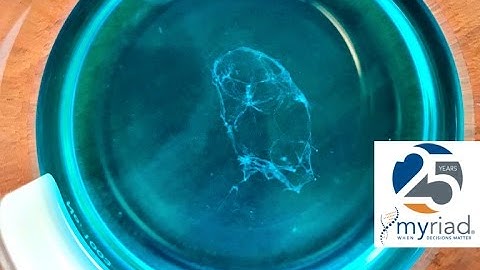 Extracting your own DNA at home -- Myriad Genetics