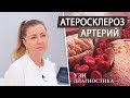 Атеросклероз артерий. УЗИ диагностика сосудов