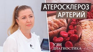 Атеросклероз артерий. УЗИ диагностика сосудов