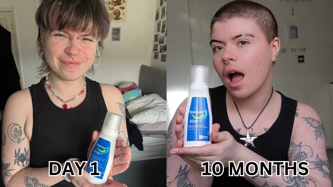 10 MONTHS ON TESTOSTERONE UPDATE!! - YouTube