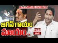 Live      jagan eye injury    mahaa news