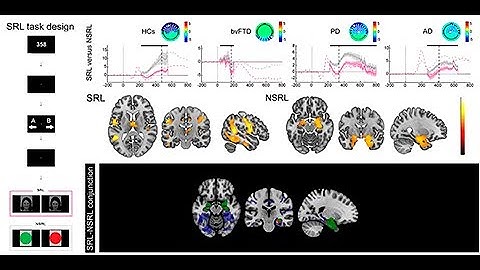 Multimodal mechanisms of human socially reinforced learning across neurodegenerative diseases
