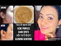 7 Days Challenge ❤️ ACNE PIMPLE जड़ से खत्म करें और पाएं  Young बेदाग़ Spotless निखार SUMMER SKINCARE