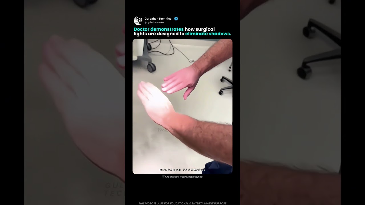 Why Surgical Lights Never Cast Shadows! 💡🩺