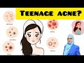 Teenage acne.Teenage acne treatment.Teenage acne solution.