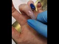 Video: Dual tip KOPER dual system forms acrygel 100 pz
