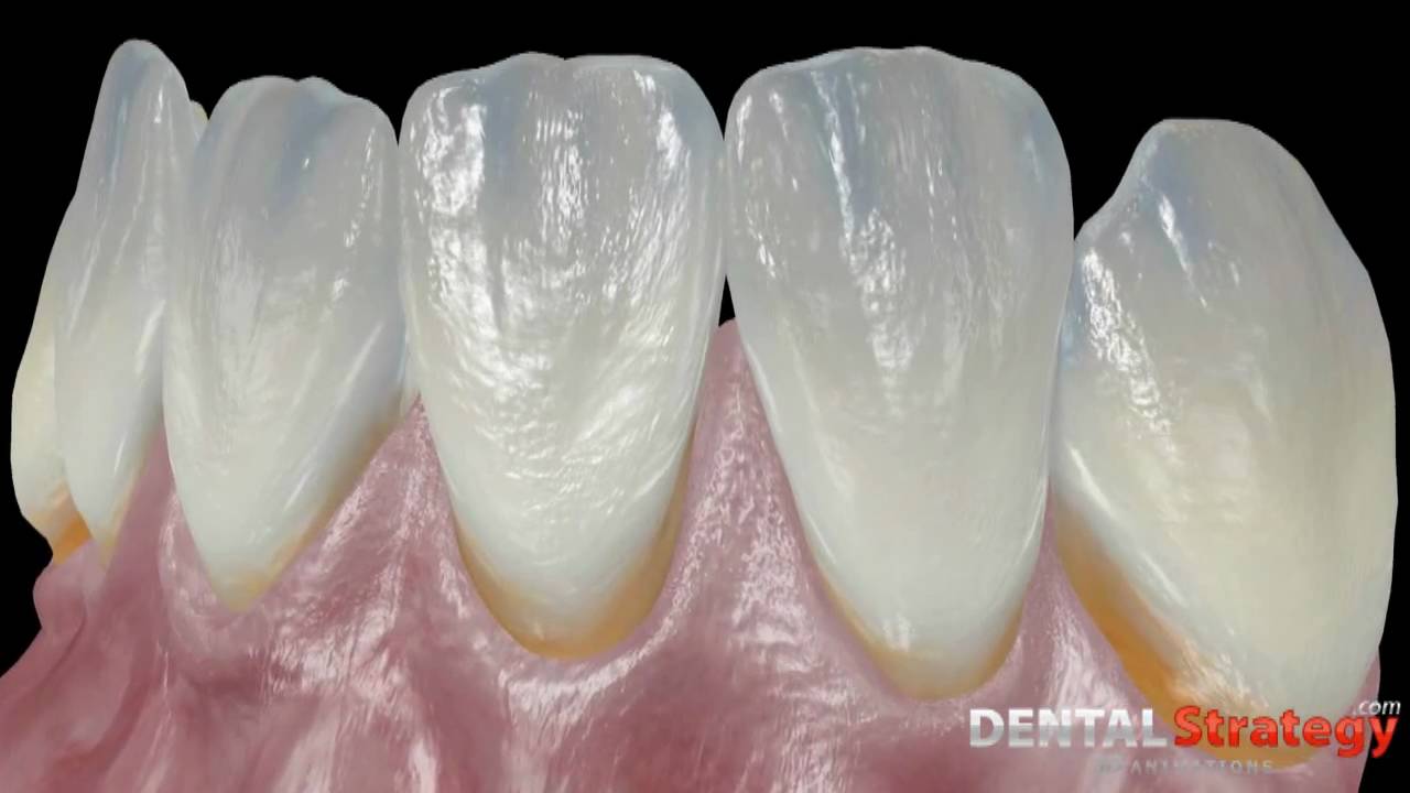 morphology of the teeth and skull youtube tooth morphology
