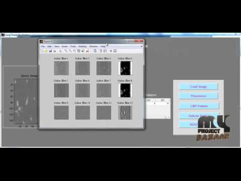 Final Year Projects 2015 | Feature-Based Image Patch Approximation for Lung Tissue Classification